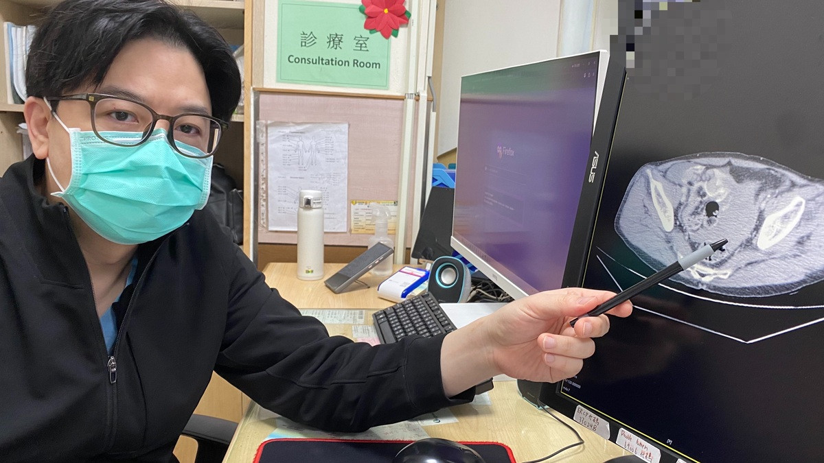 工地意外「姿勢痛」竟是腸系膜大出血：急診醫揭隱藏致命警訊，救回一命